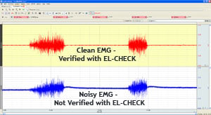 EMG data recording improves with EL-CHECK