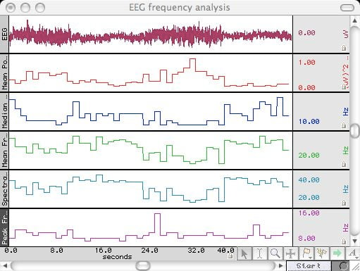 EEG100C EEG amplifier and frequency analysis using BIOPAC Acq;Knowledge software