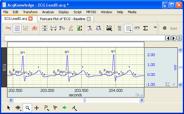 ECG Events for HRV Analysis