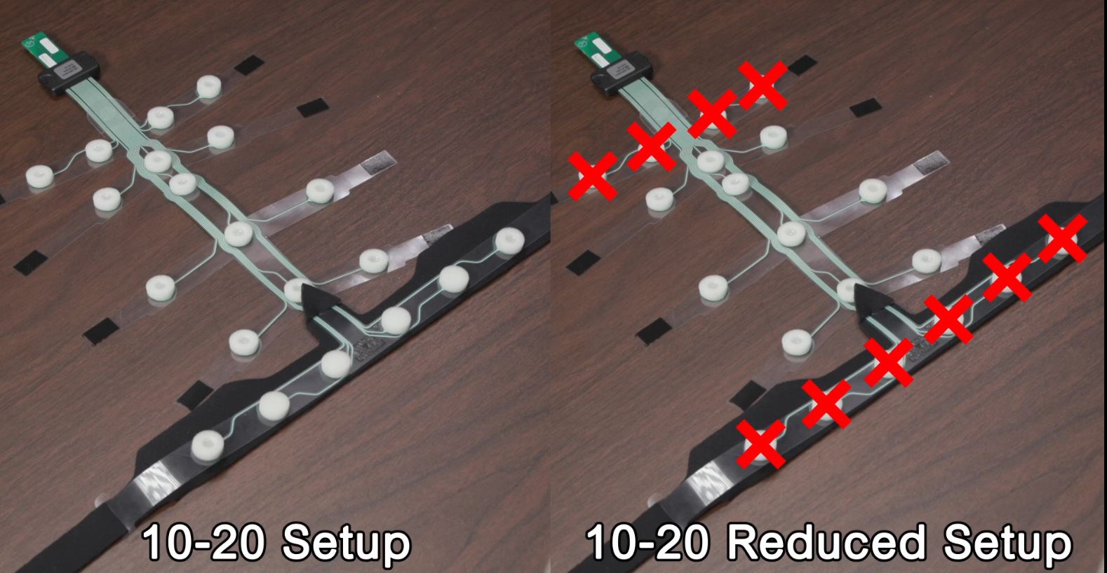 EEG Sensor for Linked Mastode 10-20 setup and reduced 10-20 LM