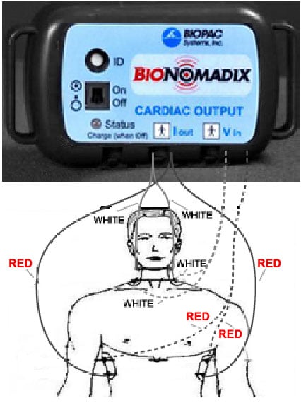 Wireless Cardiac Outout lead connection