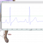 ECG Practical Lab for heart rate