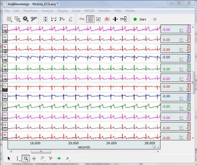 12-lead EEG acquired with wireless Mobita