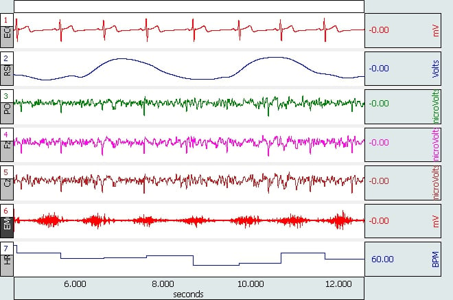 AcqKnowledge ECG, EEG, respiration, EMG heart rate data