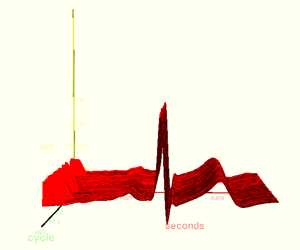 ECG analysis 3d surface plot (waterfall) of Lead II ECG recording