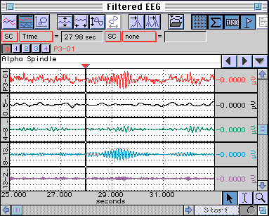 EEG data with frequency bands