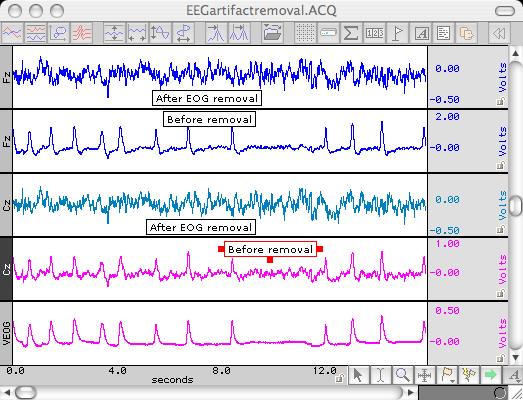 EEG with EOG Artifact Removal