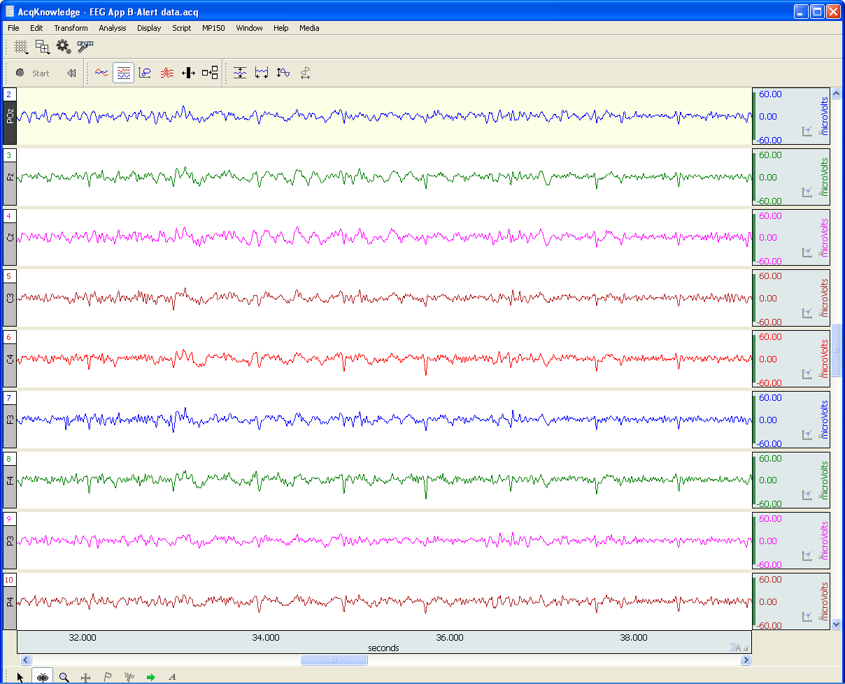 filtered EEG data