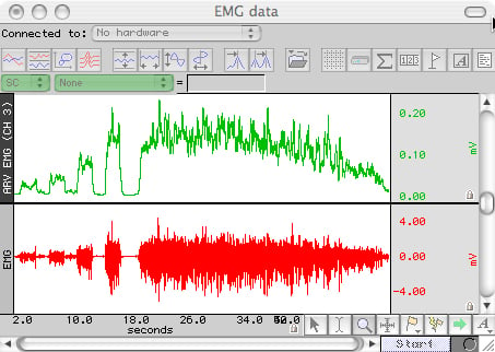 Surface EMG Integrated EMG Data