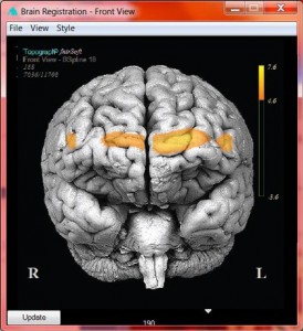FNIRSoft optical brain image