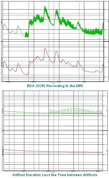 BIOPAC EDA MRI Data