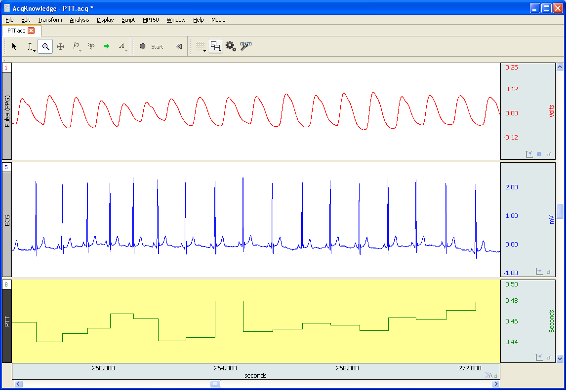 Plethysmography | Pulse Transit Time (PTT), Pulse Wave Velocity (PWV) and Amplitude (PWA) | Research BIOPAC