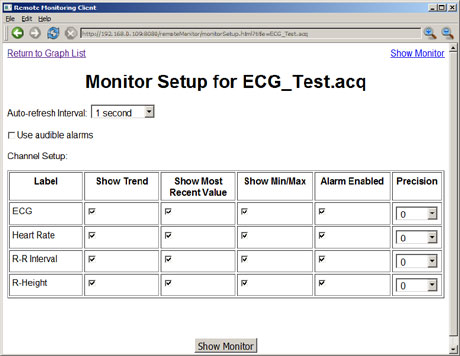 remote monitor ecg display